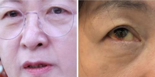 "실핏줄 터졌다"는 추미애…주진우 "윽박질러서, 힘들면 그만둬"